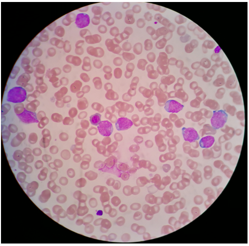 1597719870178927.png 20170919105943426.png