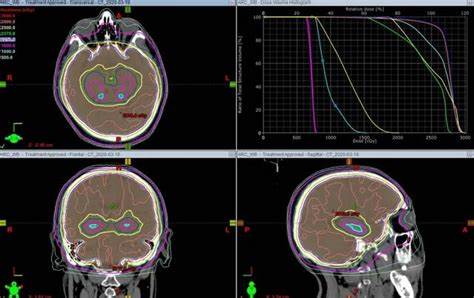 1598842789867720.jpg OIPQ5N6URWT.jpg