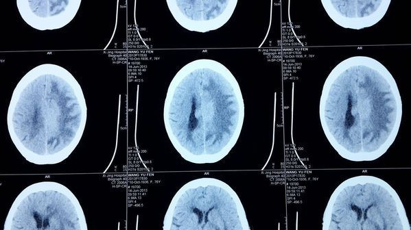 1599791636512747.jpg 0bb5e9195d164b69bdadcc7be7902324.jpg