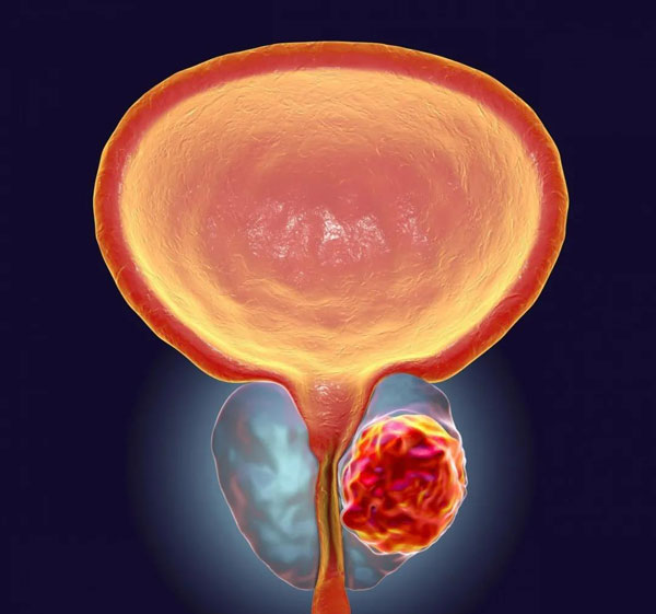 1600831062568399.jpg 微信圖片_20200923110520.jpg