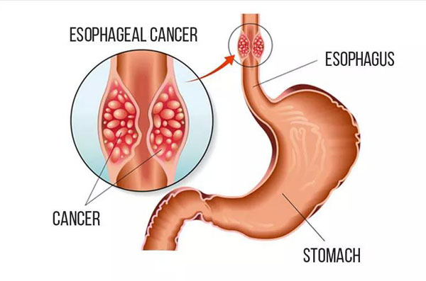 1600930660964811.jpg 微信圖片_20200924145110.jpg