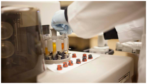 血液檢測,診斷,""