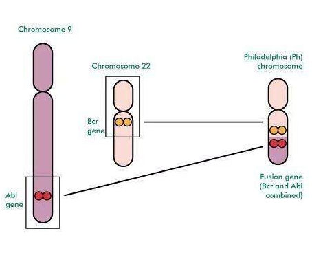 費(fèi)城染色體