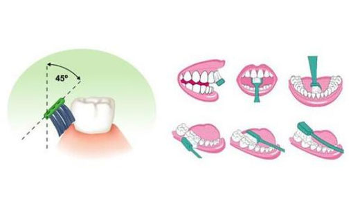 刷牙,正確的刷牙姿勢