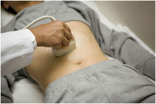 肝癌檢測,肝癌篩查