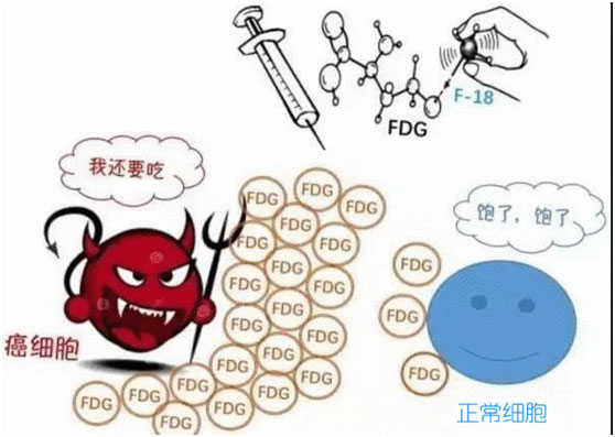 癌細(xì)胞，腫瘤細(xì)胞
