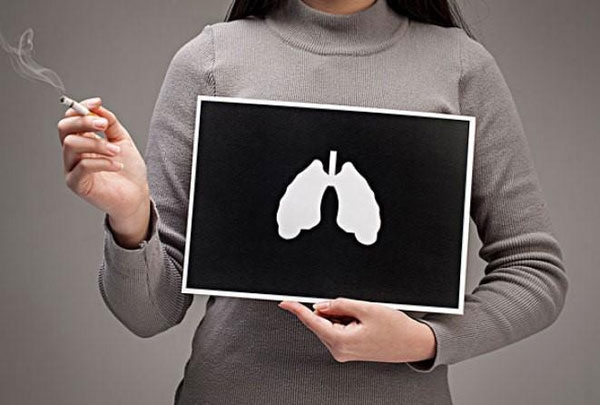 女性肺癌患者