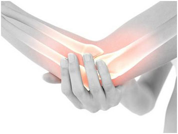 骨髓瘤和椎間盤突出