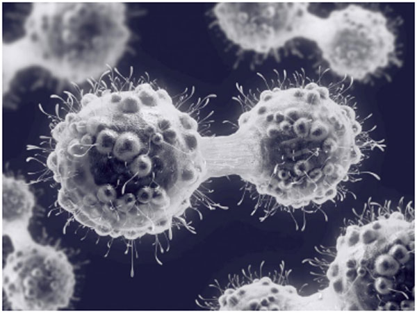 轉(zhuǎn)移性癌細(xì)胞