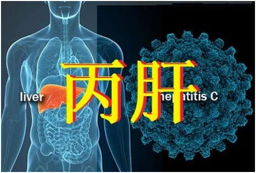 丙肝‘丙型肝炎’