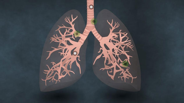 1603269077907684.jpg 1.jpg