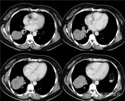 1603335098445144.jpg yxppt_2016-12-20_14-49-04.jpg