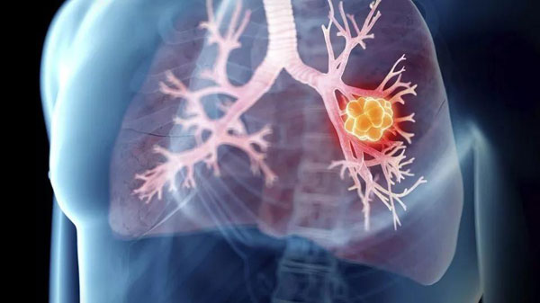 1603351718739429.jpg 01.JPG