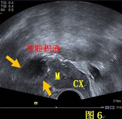 1603682220152147.jpg 20190905200135773577.jpg