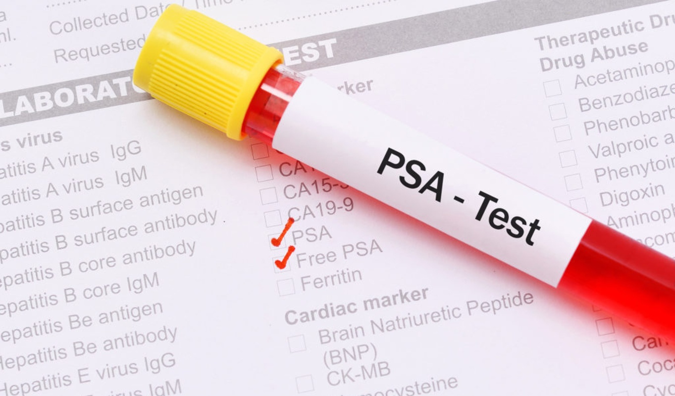 1603851124832233.jpg 前列腺癌PSA檢查.jpg