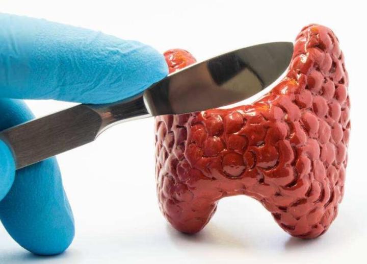 1603852336301859.jpg 甲狀腺癌手術(shù).jpg