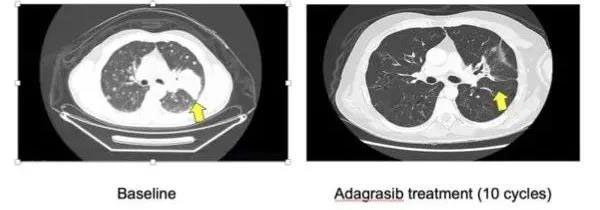 1604030139366662.jpg 微信圖片_20201030115135.jpg