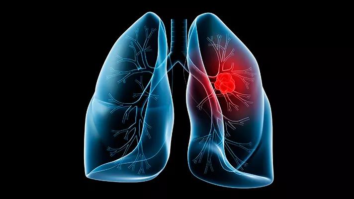 1604373023297368.jpg 微信圖片_20201103110525.jpg