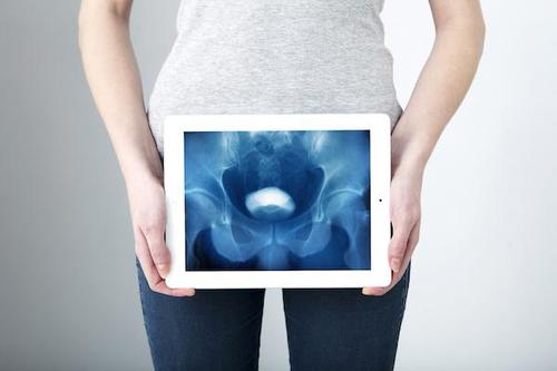 1604975668851260.jpg 膀胱癌8.jpg