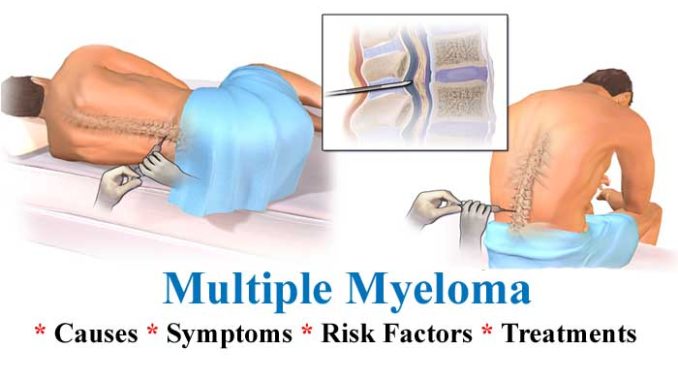 多發(fā)性骨髓瘤 (9).jpg