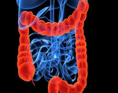 結(jié)直腸癌 (4).jpg