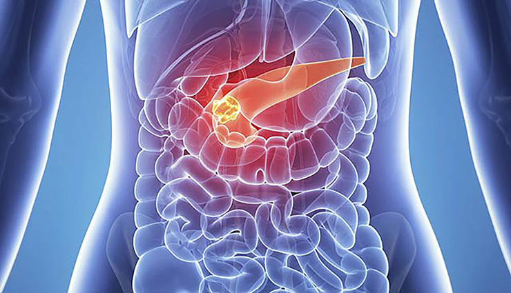 1605237094136583.jpg d7ddfbf9-06c8-47a6-b21e-18578121b825.jpg