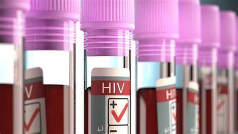 1605837415937532.jpg HIV3.jpg