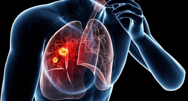 1607399772744633.jpg Rauchender-Mensch-Illustration-mit-Lunge-1024x768.jpg