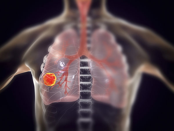 1607657352195360.jpg 6502364-thumb.jpg