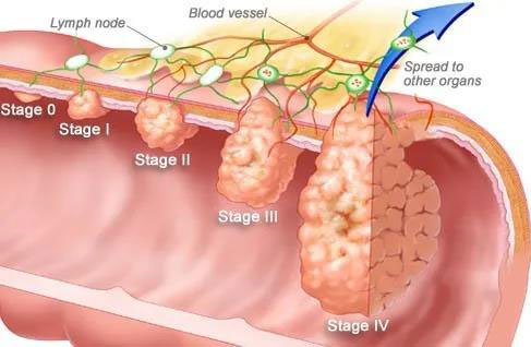 1608174796492487.jpg 1608174796492487.jpg