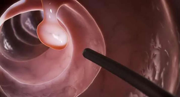 1608174834456621.jpg 微信圖片_20201217105611.jpg