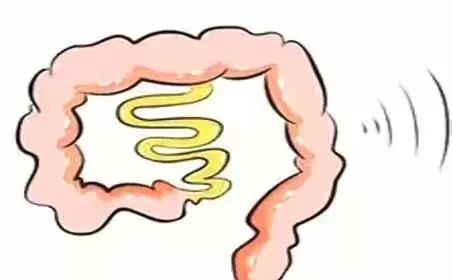 結(jié)直腸癌 (10).jpg