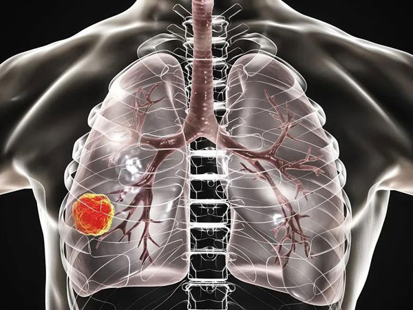 1610008125839463.jpg 微信圖片_20210107162550.jpg