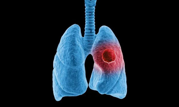 1615791361119761.jpg 微信圖片_20210315145256.jpg