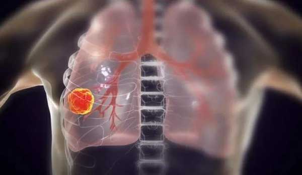 1623380347794243.jpg 微信圖片_20210611104902.jpg