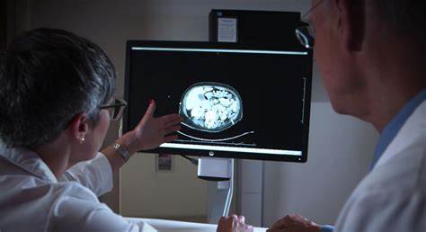 1635472599140256.jpg 肝癌 (17).jpg