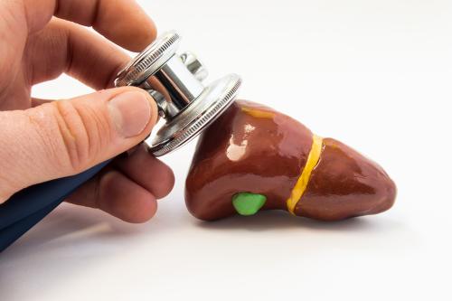 1635472618335544.jpg 肝癌14.jpg