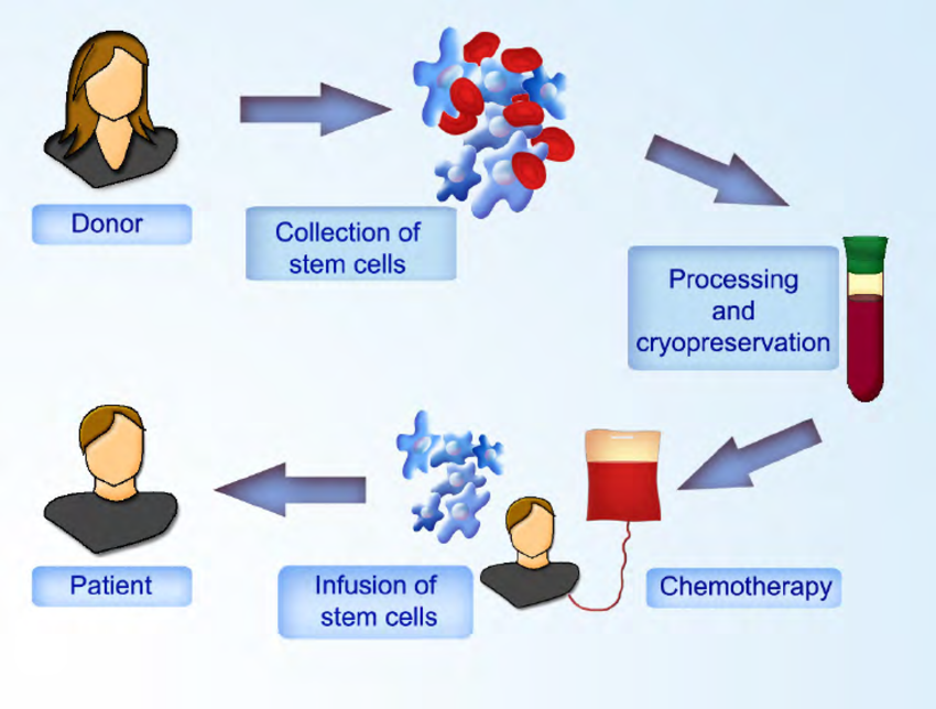 1635904565149521.png Allogeneic-stem-cell-transplantation-Hematopoietic-stem-cells-are-collected-from-the.png
