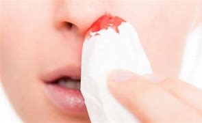 1635905425444656.jpg index.jpg