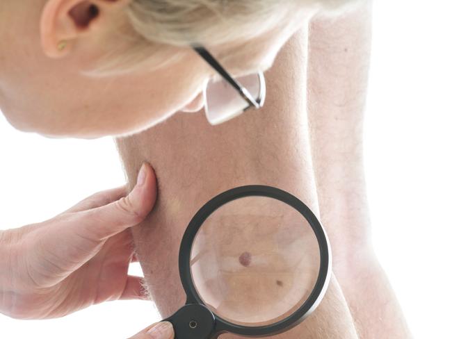 1636510587364635.jpg 黑色素瘤r.jpg