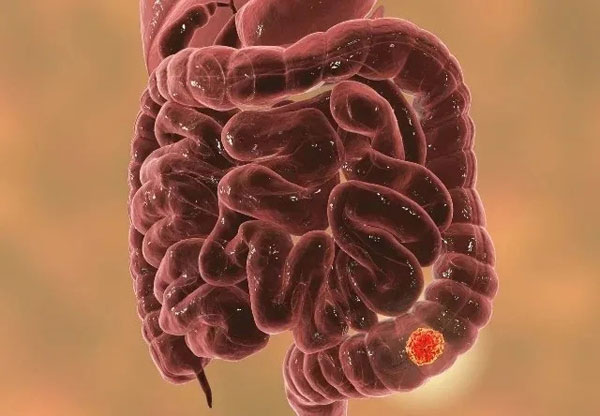 1638166740547247.jpg 123.jpg