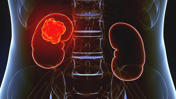 1645599780311343.jpg 20220222a.jpg