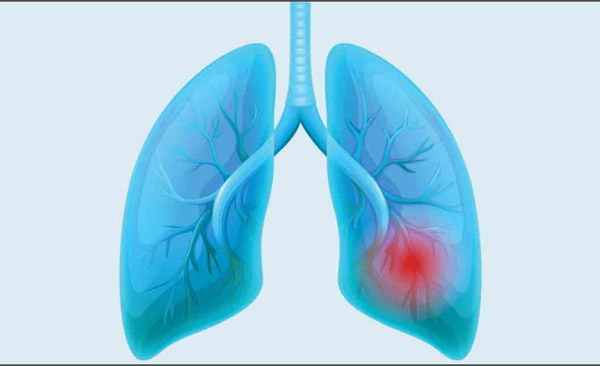 1657006669515652.jpg 20220701a.jpg