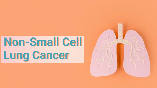 1685589288698565.png 20230522e.png