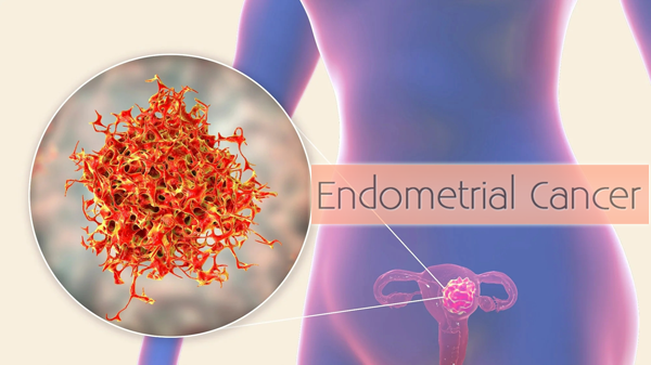 1686627500319565.png 20230608a.png