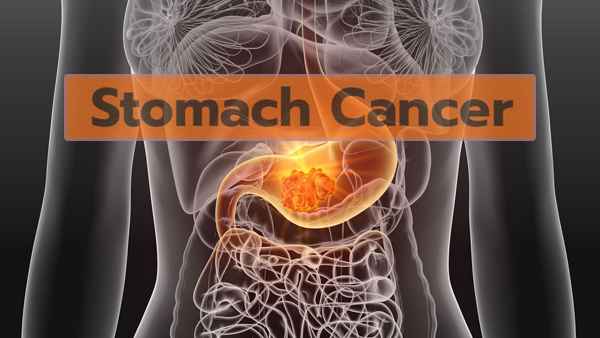 1689821549930966.png 20230706a.png