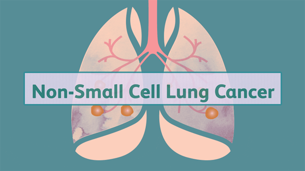 1690340555973285.png 20230710a.png