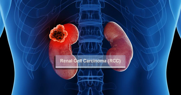 1693883831233270.png 20230821a.png