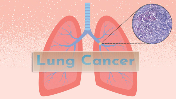 1694399459482960.png 20230802a.png