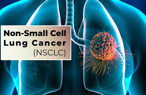 1697167564632719.png 20231011a.png